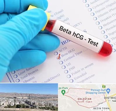 آزمایشگاه بارداری در شهرک گلستان شیراز
