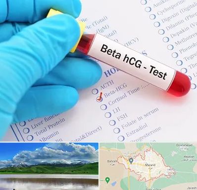 آزمایشگاه بارداری در مرند