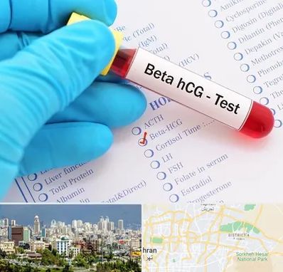 آزمایشگاه بارداری در شرق تهران 