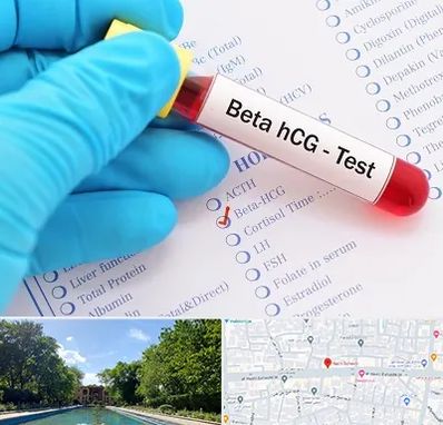 آزمایشگاه بارداری در هشت بهشت اصفهان