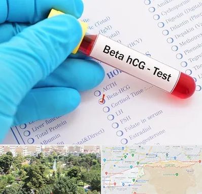 آزمایشگاه بارداری در منطقه 13 تهران 