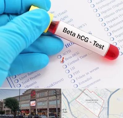 آزمایشگاه بارداری در قائمیه اسلامشهر