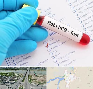 آزمایشگاه بارداری در میاندوآب