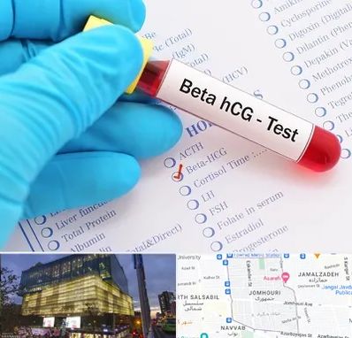 آزمایشگاه بارداری در جمهوری 