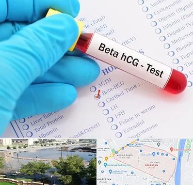 آزمایشگاه بارداری در گلستان اهواز