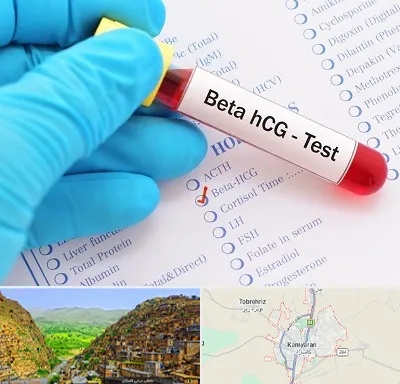 آزمایشگاه بارداری در کامیاران
