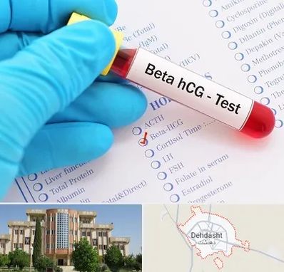 آزمایشگاه بارداری در دهدشت