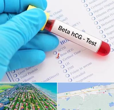 آزمایشگاه بارداری در فریدونکنار