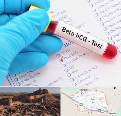 آزمایشگاه بارداری در بم