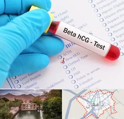 آزمایشگاه بارداری در دامغان