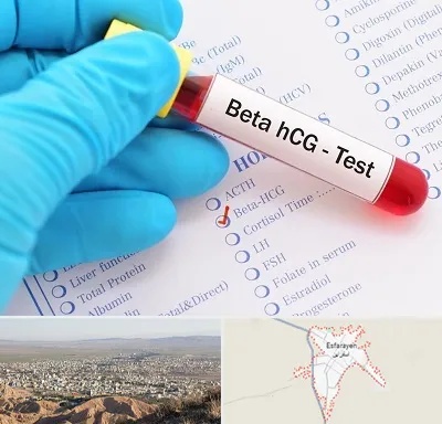 آزمایشگاه بارداری در اسفراین