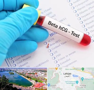 آزمایشگاه بارداری در لاهیجان