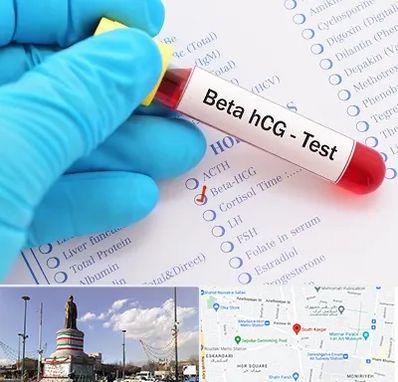 آزمایشگاه بارداری در کارگر جنوبی 