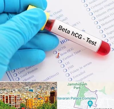 آزمایشگاه بارداری در نیاوران 