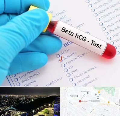 آزمایشگاه بارداری در هفت تیر مشهد