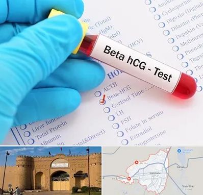 آزمایشگاه بارداری در ایرانشهر
