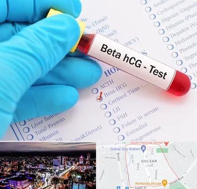 آزمایشگاه بارداری در گلسار رشت 