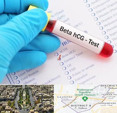 آزمایشگاه بارداری در نارمک 