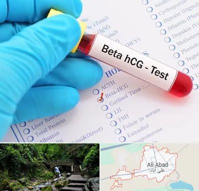 آزمایشگاه بارداری در علی آباد کتول