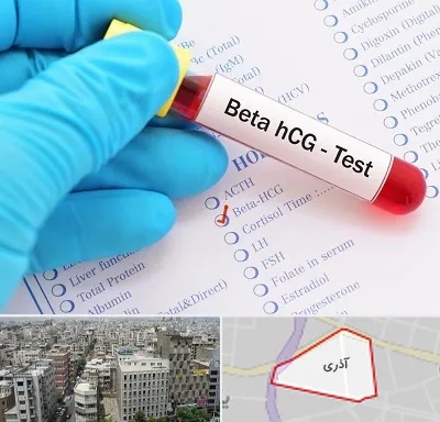 آزمایشگاه بارداری در آذری