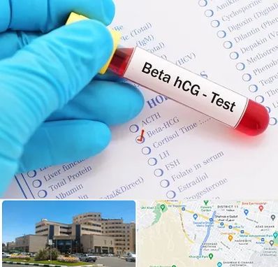 آزمایشگاه بارداری در صیاد شیرازی مشهد