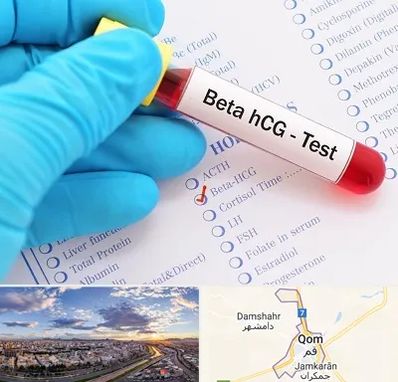 آزمایشگاه بارداری در قم