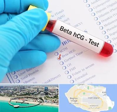 آزمایشگاه بارداری در کیش