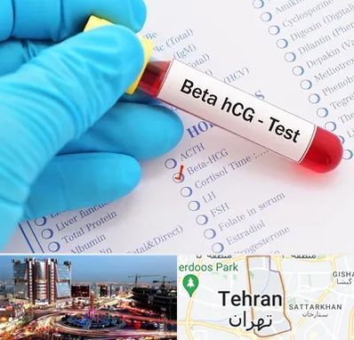 آزمایشگاه بارداری در صادقیه 