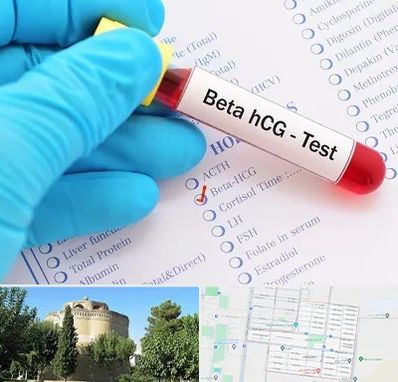 آزمایشگاه بارداری در مرداویج اصفهان