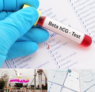 آزمایشگاه بارداری در پادادشهر اهواز