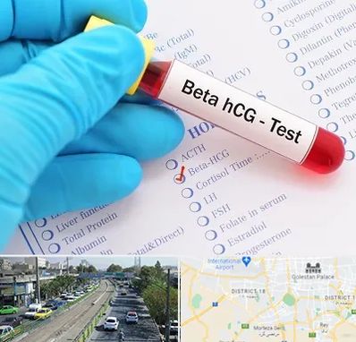 آزمایشگاه بارداری در جنوب تهران 