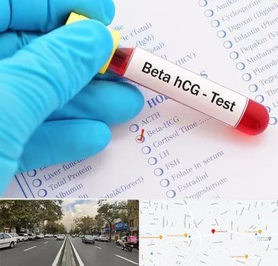 آزمایشگاه بارداری در دولت