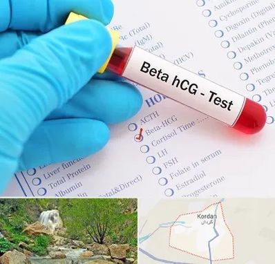 آزمایشگاه بارداری در کردان