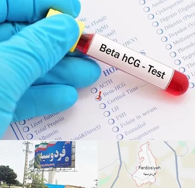آزمایشگاه بارداری در فردوسیه شهریار