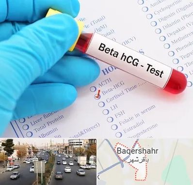 آزمایشگاه بارداری در باقرشهر