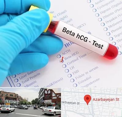 آزمایشگاه بارداری در خیابان آذربایجان