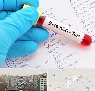 آزمایشگاه بارداری در محمد شهر کرج