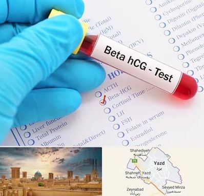 آزمایشگاه بارداری در یزد