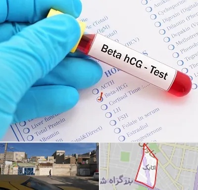 آزمایشگاه بارداری در اتابک