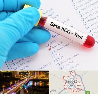 آزمایشگاه بارداری در سقز