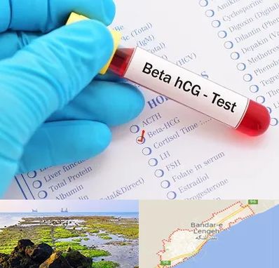 آزمایشگاه بارداری در بندرلنگه
