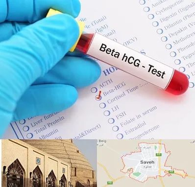 آزمایشگاه بارداری در ساوه