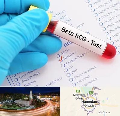 آزمایشگاه بارداری در همدان