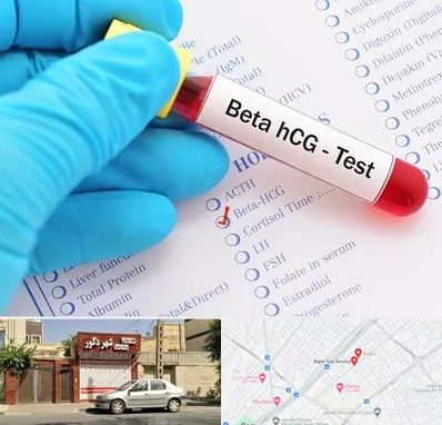 آزمایشگاه بارداری در باجک قم