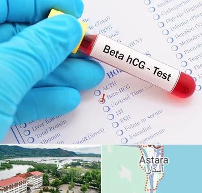 آزمایشگاه بارداری در آستارا