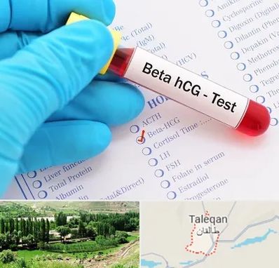 آزمایشگاه بارداری در طالقان