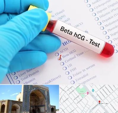 آزمایشگاه بارداری در مصلی مشهد