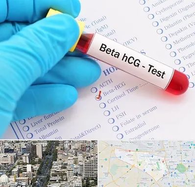 آزمایشگاه بارداری در منطقه 18 تهران 