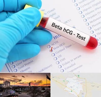 آزمایشگاه بارداری در قوچان