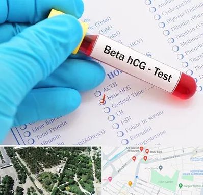 آزمایشگاه بارداری در سالاریه قم
